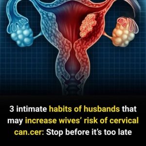 3 Intimate Habits of Husbands That May Increase Wives’ Risk of Cervical Can.cer
