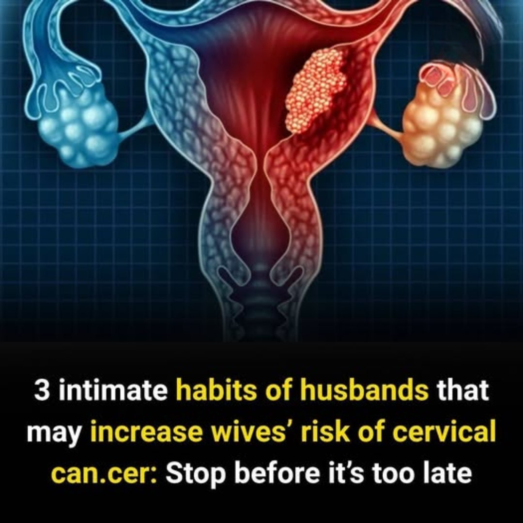 3 Intimate Habits of Husbands That May Increase Wives’ Risk of Cervical Can.cer