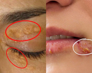 4 Subtle Signs on Your Face That Could Signal Health Problems