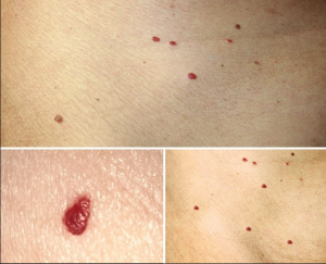 11 Reasons Why You Have Red Dots On Your Skin