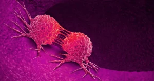 Itching in 9 Areas: A Warning Sign of Malignant Tumors, Number 7 Is the Most Common