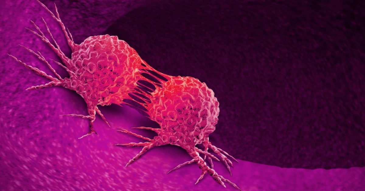 Itching in 9 Areas: A Warning Sign of Malignant Tumors, Number 7 Is the Most Common