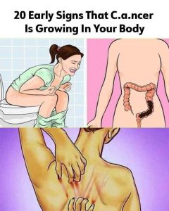 20 subtle cancer symptoms commonly missed