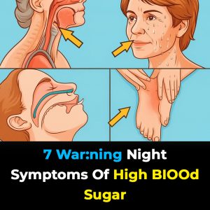 Recognizing high bl00d sugar: 7 early signs you should not ignore