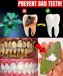 Top 3 Ways to Treat Tooth Decay with Guava Leaves – Simple and Cost-Effective