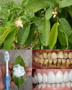 Top 3 Ways to Treat Tooth Decay with Guava Leaves – Simple and Cost-Effective