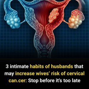3 Intimate Habits of Husbands That May Increase Wives’ Risk of Cervical Can.cer