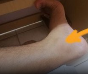 How Your Feet Can Reveal Early Signs of Diabetes