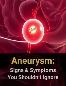 12 signs that may signal a brain aneurysm — Don’t ignore them