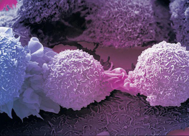 Scientists Discover Body’s Capable Destroying Cancer Cells