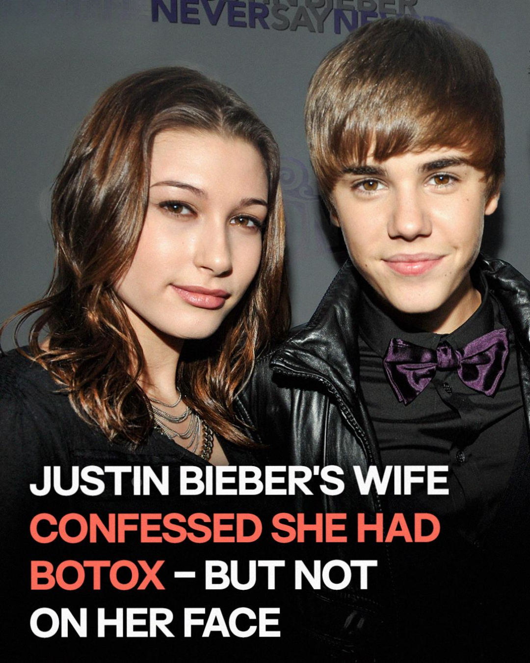 Hailey Bieber Admits Getting Botox