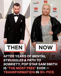Transformation of Oscar-Winning Singer Sam Smith, Who Was ‘Scared’ of Fame for Years – 30+ Photos