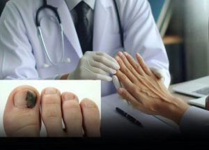 Notice These 3 Limb Changes? Don’t Ignore Them — They May Be Linked to Can.cer