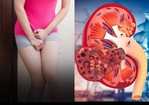 Your Kid.neys Are in Trouble If You Notice These Symptoms