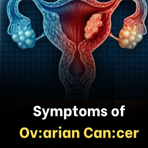 Ovarian and breast cancer are among the most common types of can:cer affecting women