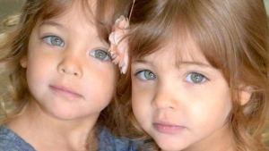 At 7 years old, they were called the most beautiful twins in the world. Now they’ve grown up — look what they look like today