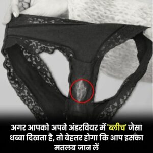 अंडरवियर पर हल्के रंग का धब्बा: जानिए इसका असली वैज्ञानिक कारण और स्वच्छता से जुड़े जरूरी तथ्य