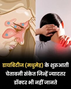 डायबिटीज के छिपे हुए शुरुआती संकेत: गर्दन, सिरदर्द, साइनस और त्वचा के अनसुने लक्षण