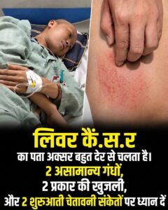 लिवर की गंभीर बीमारी के छिपे हुए संकेत: 2 अजीब गंध, 2 प्रकार की खुजली और 2 शुरुआती चेतावनियाँ जिन्हें पहचानना ज़रूरी है