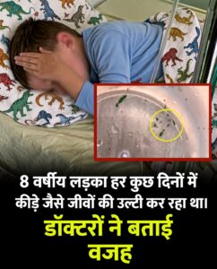 हर कुछ दिनों में अजीब जीवों की उल्टी होने का क्या था कारण? जानिए डॉक्टरों का खुलासा और पेट की सुरक्षा के नियम