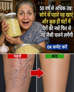 50 की उम्र के बाद पैरों की उभरी नसों और कमजोर रक्त संचार के लिए लहसुन का यह उपाय: जानिए सही तरीका और सावधानियां