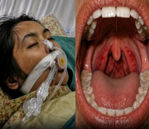 22 वर्षीय महिला की गले में खराश के सिर्फ़ पाँच दिन बाद मौत हो गई—डॉक्टरों ने 5 ऐसे संकेतों की चेतावनी दी जिन्हें कभी नज़रअंदाज़ नहीं करना चाहिए।