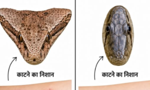 अगर सांप काट ले तो घबराएं नहीं, तुरंत उठाएं ये कदम